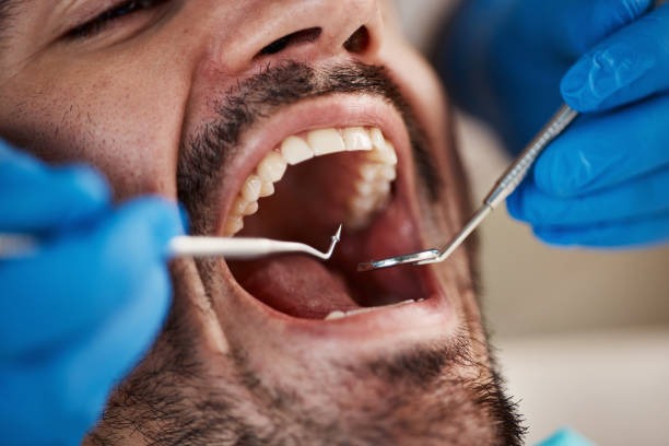 Best Emergency TMJ Treatment in Bay Springs, MS