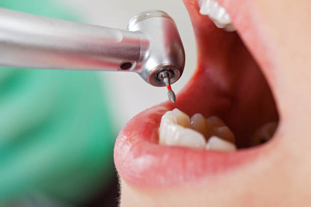 Best Weekend Emergency Dentist in Bay Springs, MS